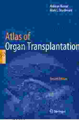 Atlas Of Organ Transplantation Nick Jackson