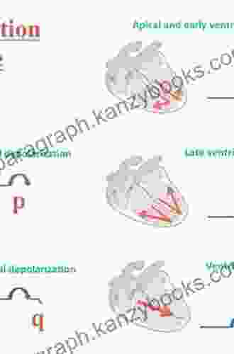 ECGs Made Easy E